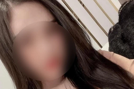 Vụ cô gái tử vong khi nâng mũi: Một bác sĩ BV Ung bướu Hà Nội bị tạm đình chỉ công tác