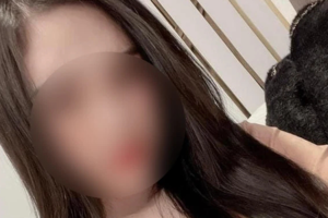 Vụ cô gái tử vong khi nâng mũi: Một bác sĩ BV Ung bướu Hà Nội bị tạm đình chỉ công tác