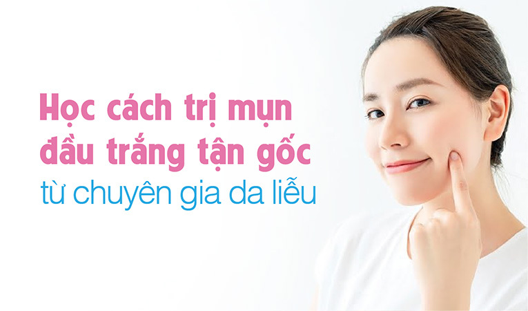 cách trị mụn đầu trắng