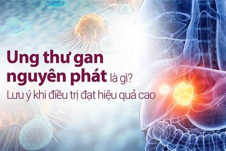 Ung thư gan nguyên phát là gì? Lưu ý khi điều trị đạt hiệu quả cao