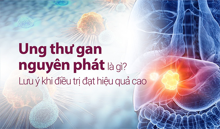 Ung thư gan nguyên phát