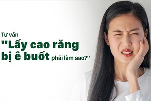 Tư vấn “lấy cao răng bị ê buốt phải làm sao?”