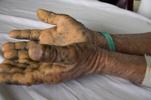 Tự dùng thuốc để tăng cường 'bản lĩnh', người đàn ông nhận cái kết đáng sợ