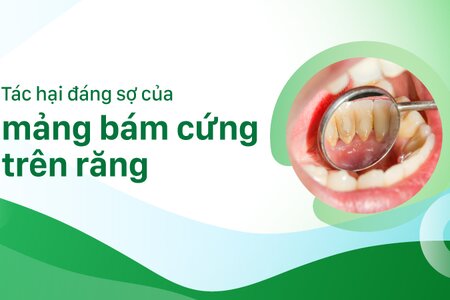 Tác hại đáng sợ của mảng bám cứng trên răng
