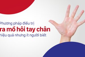 Phương pháp điều trị ra mồ hôi tay chân hiệu quả nhưng ít người biết