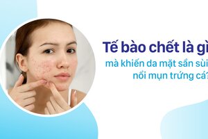 Tế bào chết là gì mà khiến da mặt sần sùi, nổi mụn trứng cá?