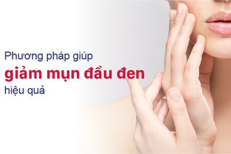 Phương pháp giúp giảm mụn đầu đen hiệu quả cho da căng mịn