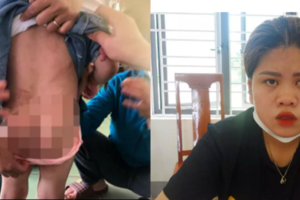 Vụ bé 4 tuổi nhập viện với nhiều vết thương: Phẫn nộ lời khai của dì ruột