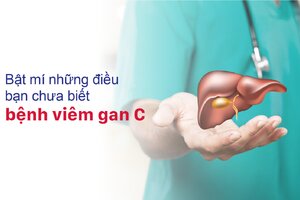 Bật mí những điều bạn chưa biết về bệnh viêm gan C