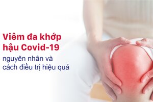 Viêm đa khớp hậu Covid-19: Nguyên nhân và cách điều trị hiệu quả