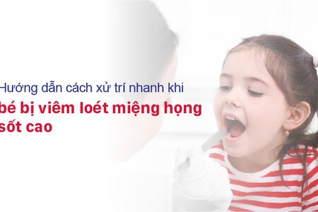 Hướng dẫn cách xử trí nhanh khi bé bị viêm loét miệng họng sốt cao