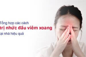 Tổng hợp các cách trị nhức đầu viêm xoang tại nhà hiệu quả
