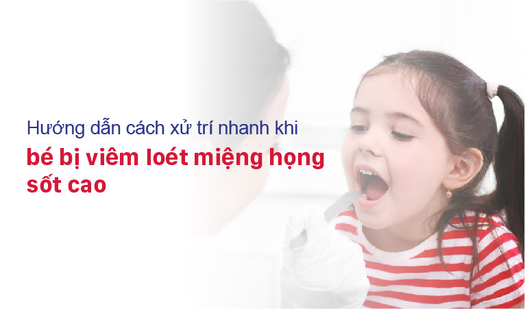 Bé bị viêm loét miệng họng sốt cao