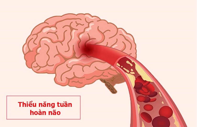 đau đầu chóng mặt