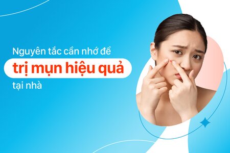 Nguyên tắc cần nhớ để trị mụn hiệu quả tại nhà