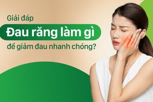 Giải đáp “Đau răng làm gì để giảm đau nhanh chóng?”