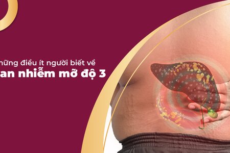 Những điều ít người biết về gan nhiễm mỡ độ 3