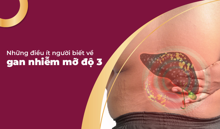 Gan nhiễm mỡ độ 3