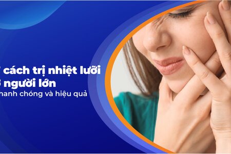 7 cách trị nhiệt lưỡi ở người lớn nhanh chóng và hiệu quả