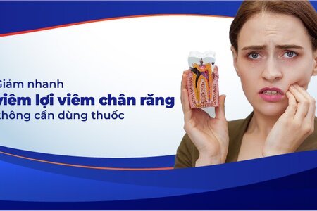 Giảm nhanh viêm lợi viêm chân răng không cần dùng thuốc