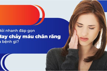 Hỏi nhanh đáp gọn “Hay chảy máu chân răng là bệnh gì?”