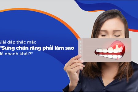 Giải đáp thắc mắc sưng chân răng phải làm sao để nhanh khỏi?