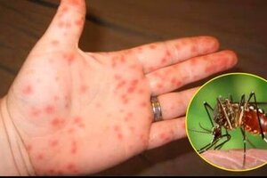 Sốt xuất huyết có thể thành đại dịch năm 2022