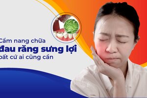 Cẩm nang chữa đau răng sưng lợi bất cứ ai cũng cần