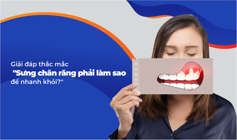 Sưng chân răng phải làm sao