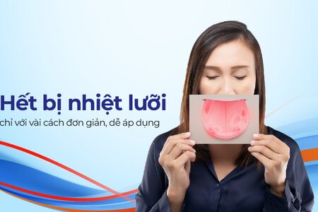 Hết bị nhiệt lưỡi chỉ với vài cách đơn giản, dễ áp dụng