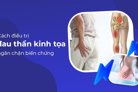 Đau thần kinh tọa và cách điều trị, ngăn chặn biến chứng