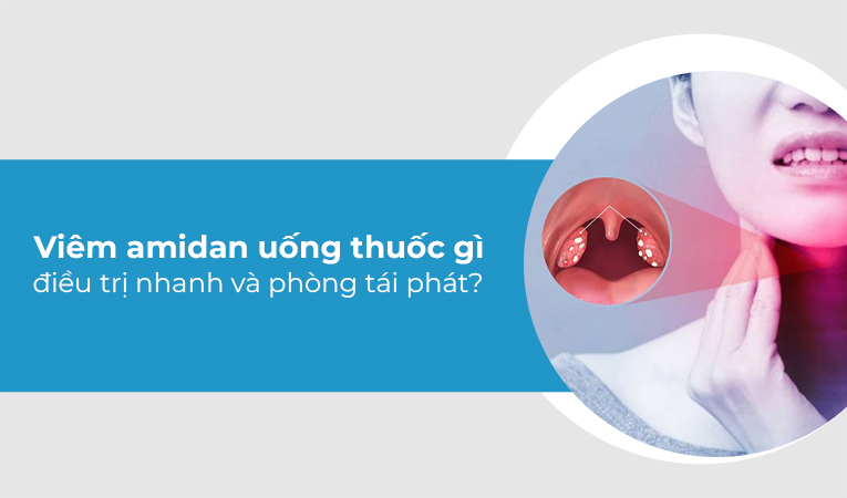 viêm amidan uống thuốc gì