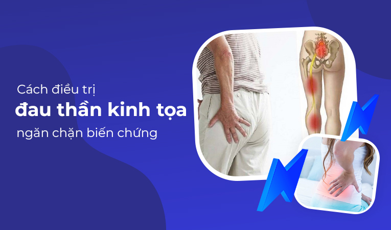 Đau thần kinh tọa