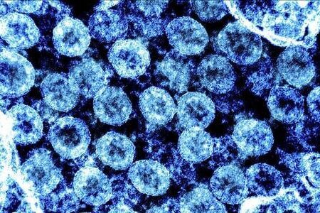 Tìm thấy 47 đột biến của chủng virus đậu mùa khỉ đang lây lan toàn cầu