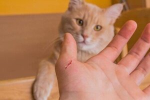 Bị mèo cắn nhưng không tiêm phòng dại, thiếu nữ 16 tuổi tử vong