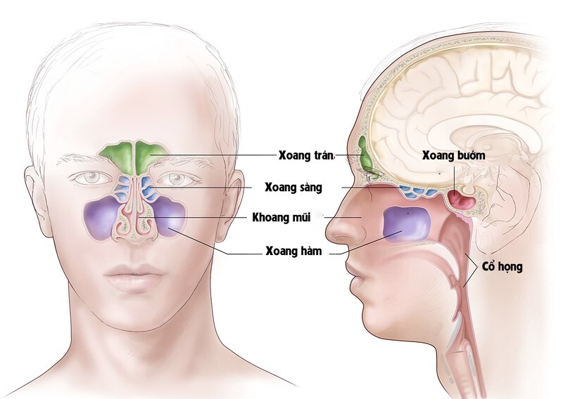 Viêm xoang sàng sau mãn tính