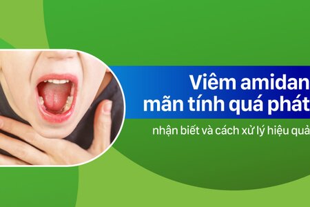 Nhận biết viêm amidan mãn tính quá phát và cách xử lý hiệu quả