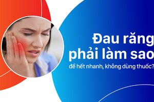 Tìm hiểu đau răng phải làm sao để hết nhanh, không dùng thuốc