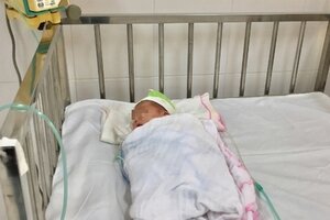 Chào đời tại nhà, bé sơ sinh nguy kịch do bị uốn ván
