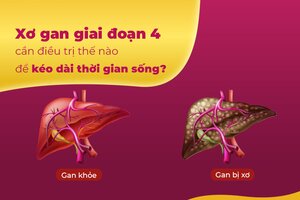 Xơ gan giai đoạn 4 cần điều trị thế nào để kéo dài thời gian?