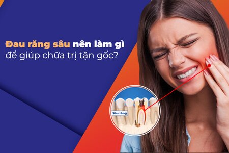 Đau răng sâu nên làm gì để giúp chữa trị tận gốc?