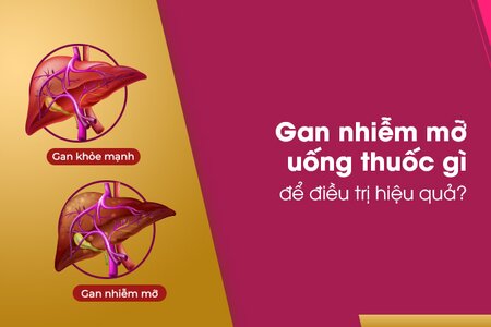 Gan nhiễm mỡ uống thuốc gì để điều trị hiệu quả?