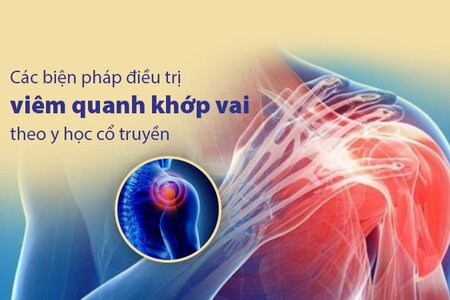 Các biện pháp điều trị viêm quanh khớp vai theo y học cổ truyền 