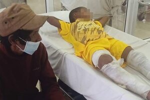 Sự thật ngã ngửa vụ 'bé trai ở Đắk Lắk bị đốt bỏng chân khi bị ép đi lấy trộm mủ cao su'