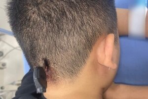 Nam thanh niên bị chìa khóa cắm vào đầu, xuyên qua xương sọ