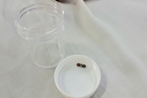 Nuốt món đồ chơi quen thuộc, bé gái 3 tuổi phải nhập viện cấp cứu