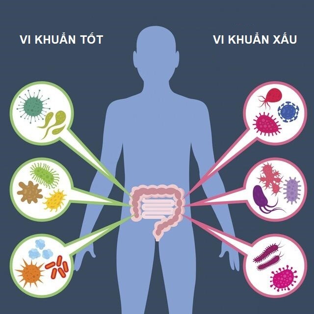 bổ sung probiotic