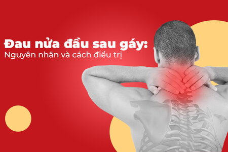 Đau nửa đầu sau gáy: Nguyên nhân và cách điều trị