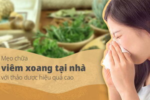 Mẹo chữa viêm xoang tại nhà với thảo dược hiệu quả cao