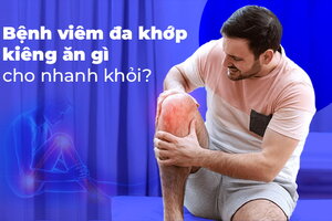 Bệnh viêm đa khớp kiêng ăn gì cho nhanh khỏi?